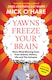 image 1 of Yawns Freeze Your Brain