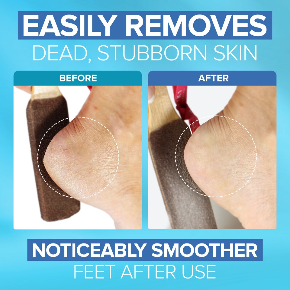 image 1 of NYK1 Smoothie Waterproof Foot File (for Wet & Dry Use) High-Performance Feet Exfoliator