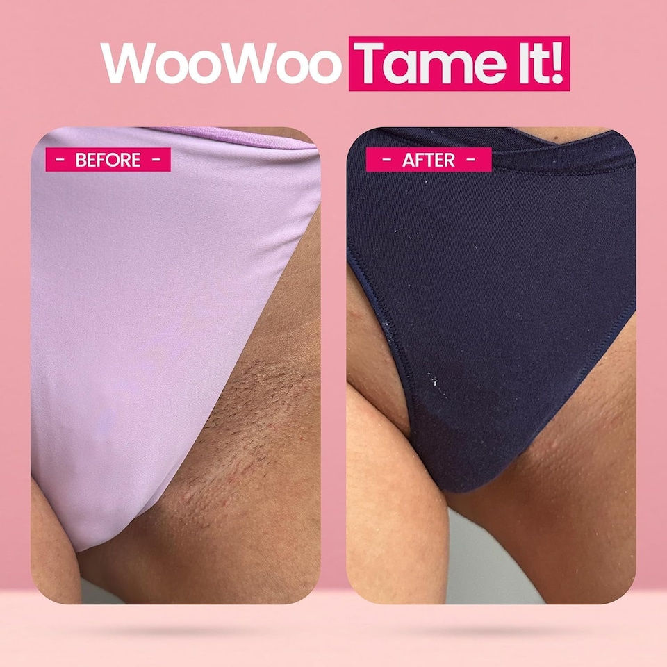 image 1 of WooWoo Tame It Natural Intimate Hair Removal Cream - Painless Vegan Hair Remover For Sensitive Skin - 50ml