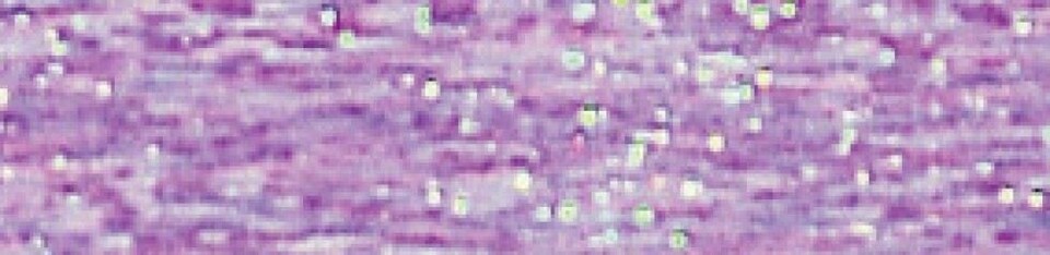 Madeira Purple Metallic 50 Thread, 500m per ball - per value pack of 5